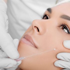 cropped woman face getting facelift , procedure mesothreads lifting skin