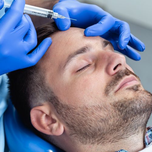 Mesobotox Darmstadt Faltenunterspritzung