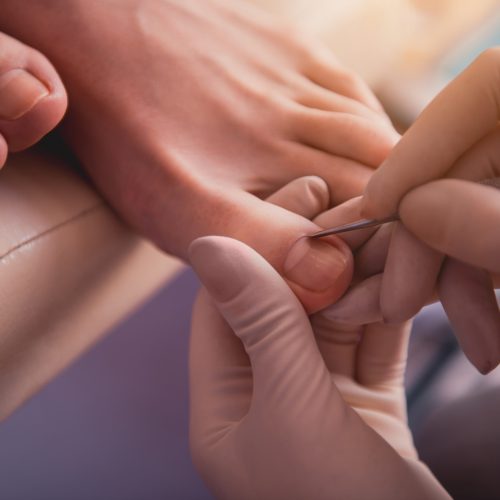 Dermatolgische Fußpflege bei Contour Lines