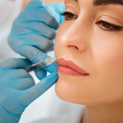 Ästhetische Lippenbehandlung mit feiner Nadelführung