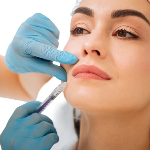Lippenkontur nach professioneller Hyaluron-Behandlung